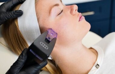 NuView Medspa- Morpheus8 FACE