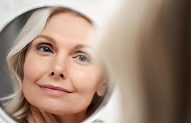 Radiesse at NuView Medspa in Venice, Florida