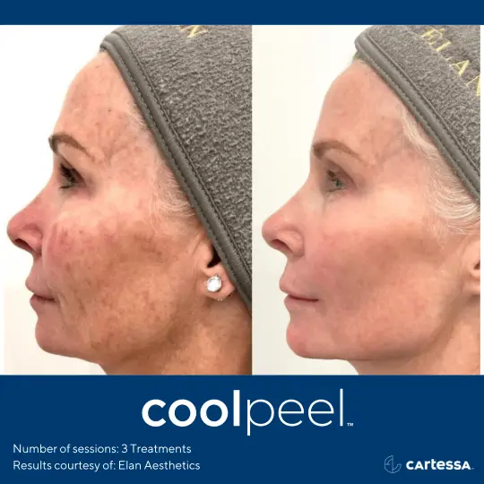 CoolPeelBAFemaleFace