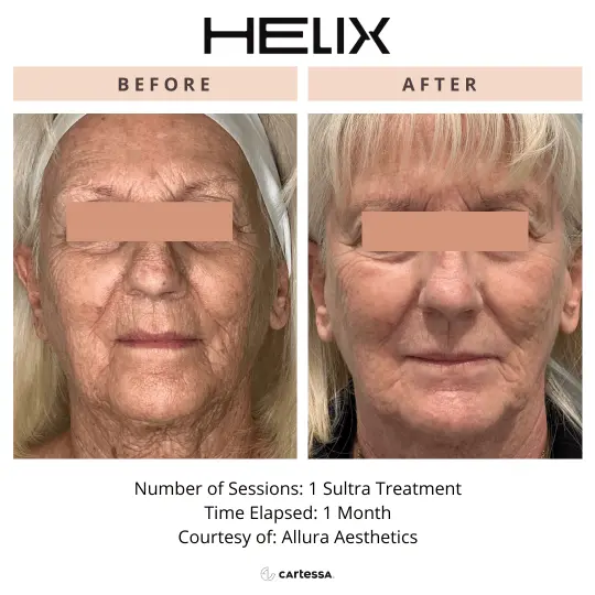 Helix