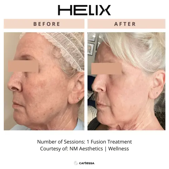 Helix