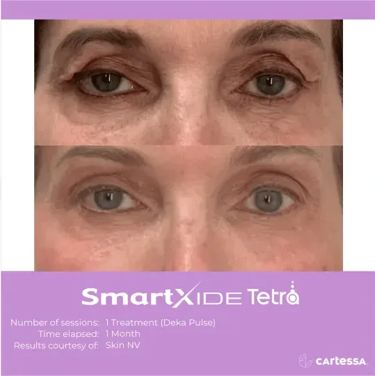 nuviewmedspafl