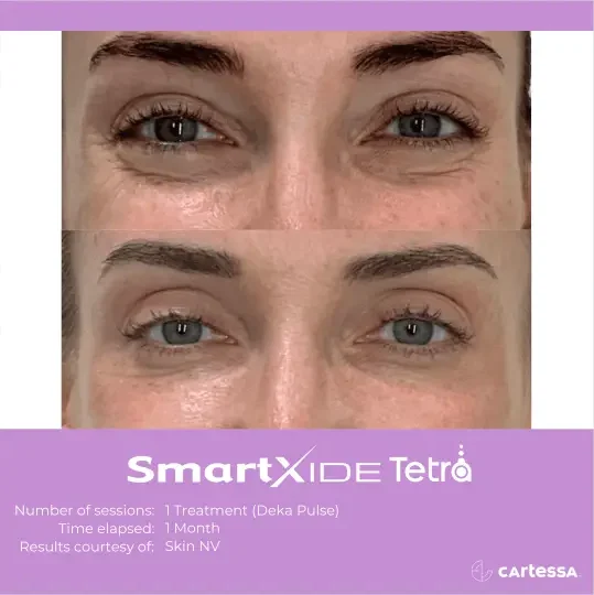 nuviewmedspafl