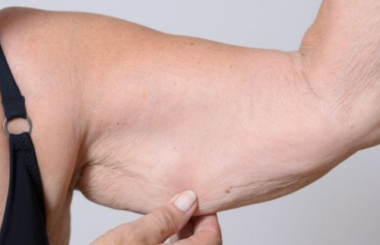 Weight Loss Injections
