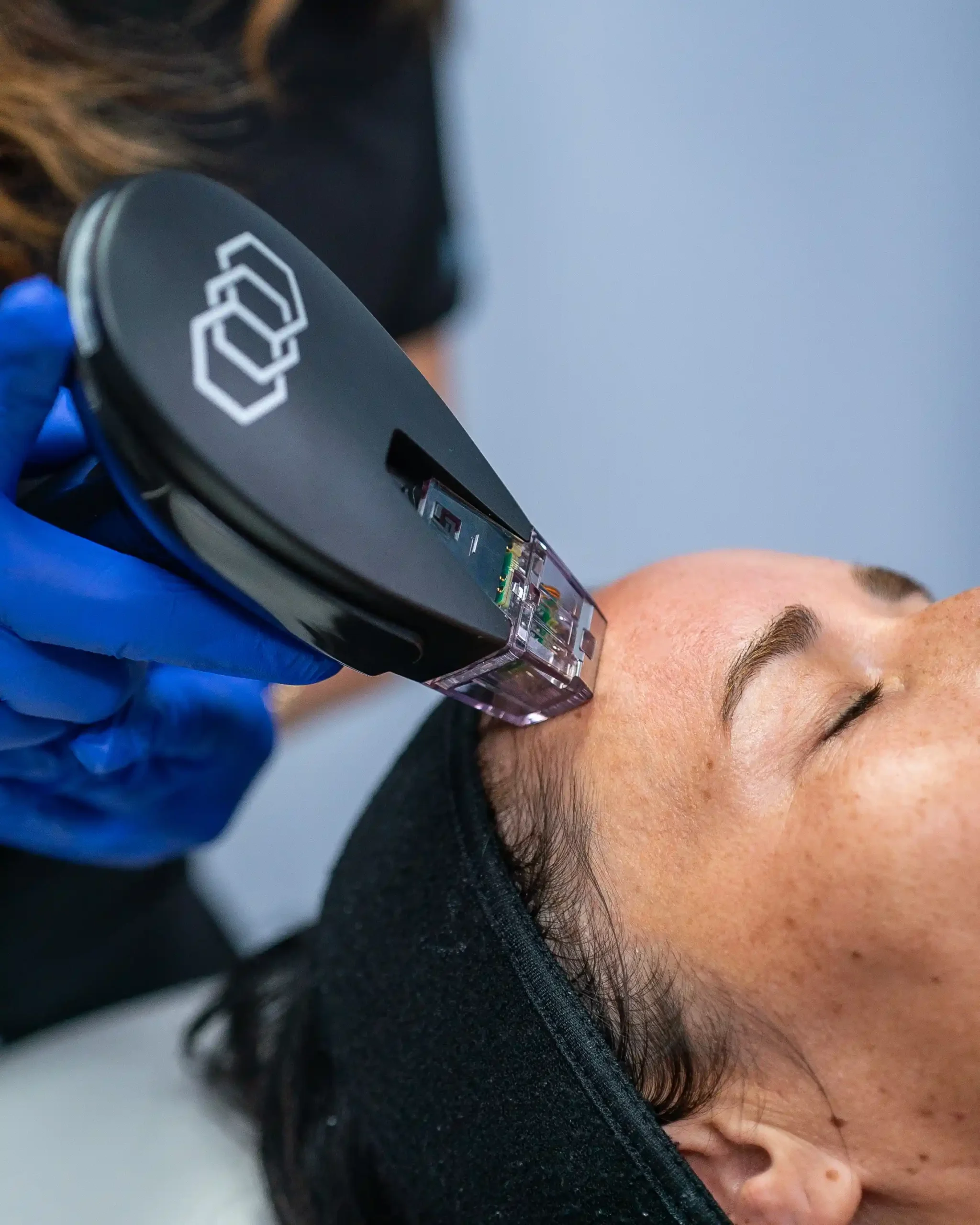 Burst Treatment