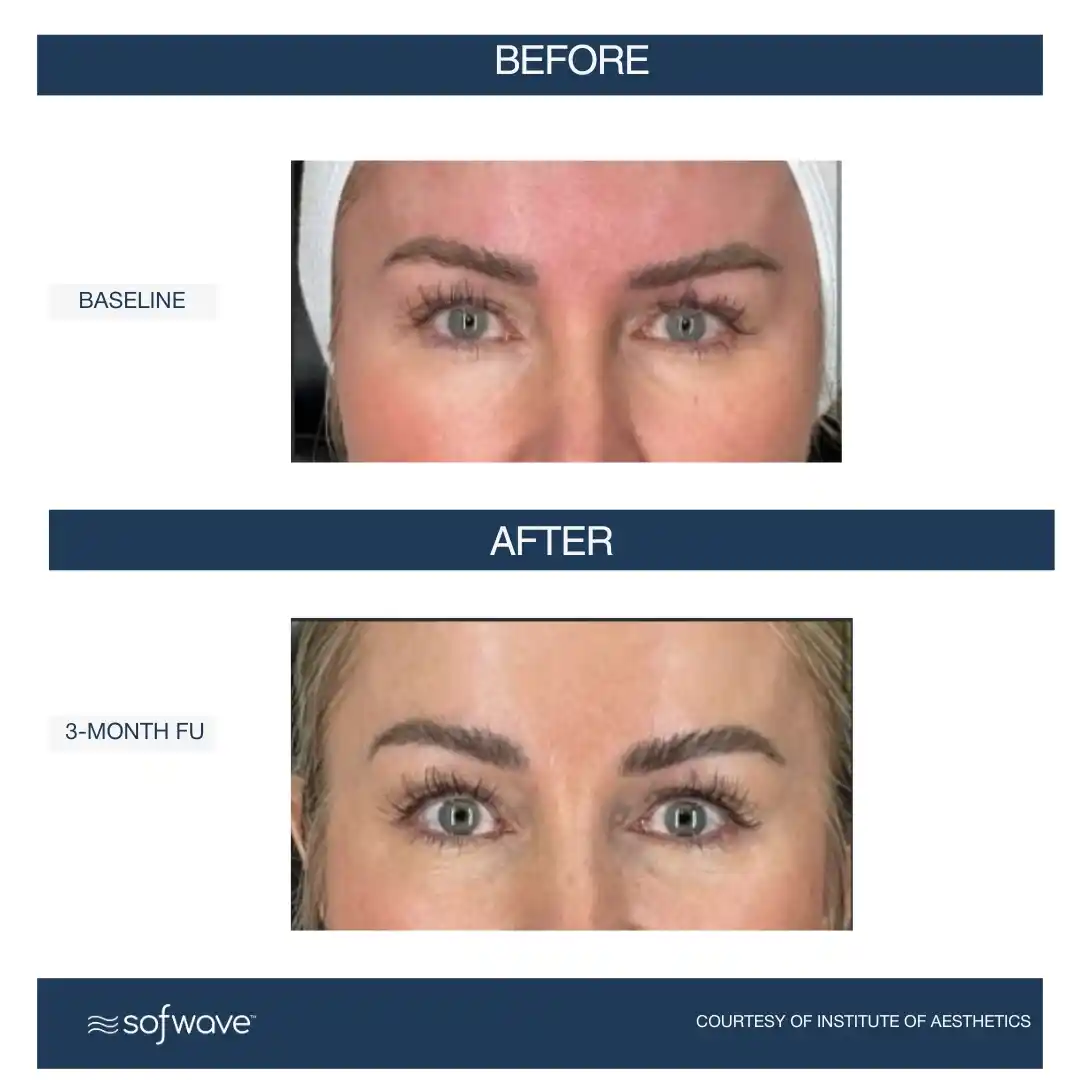 Set-104-Eyebrows